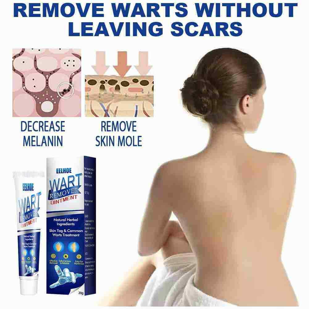 Wart Remover Instant Blemish Removal Cream 100Mg Pack of 2