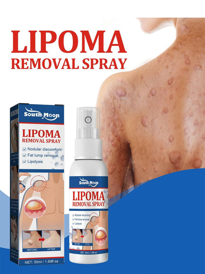 LipoCare™ Lipoma Removal Cream 🩺